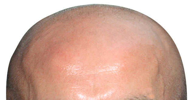 Image default
